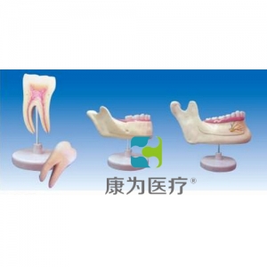 “康為醫(yī)療”磨牙、乳牙、橫牙解剖(自然大)