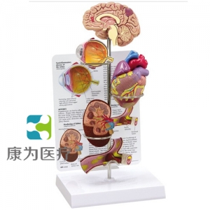 “康為醫(yī)療”醫(yī)患關(guān)系溝通模型-微型腦、眼、心、腎及動(dòng)脈模型 （醫(yī)學(xué)指導(dǎo)模型）