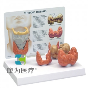 “康為醫(yī)療”細(xì)胞亞顯微結(jié)構(gòu)模型“康為醫(yī)療”醫(yī)患關(guān)系溝通模型-甲狀腺帶軟骨、氣管模型（醫(yī)學(xué)指導(dǎo)模型）