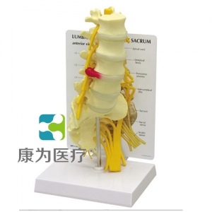 “康為醫(yī)療”醫(yī)患關(guān)系溝通模型-骶骨附腰神經(jīng)、右側(cè)骶骨神經(jīng)和坐骨神經(jīng)模型 （醫(yī)學指導模型）