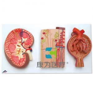 腎切面、腎單位、血管和腎小體模型