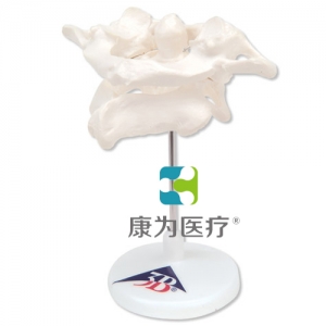 環(huán)椎和樞椎組合，置于可拆卸基架