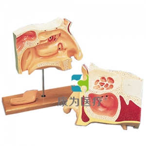 鼻竇內(nèi)窺鏡使用訓(xùn)練模型，2部分-德文注釋